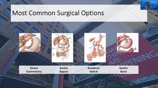 Weight Loss Surgery Q&A: Most Common Surgical Options