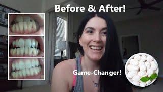 Reverse Cavities/Receeding Gums with Xylitol: You NEED to try this!