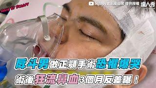 【戽斗男做正顎手術恐懼爆哭 術後狂流鼻血3個月反差曝】｜Scropy史刮皮日常