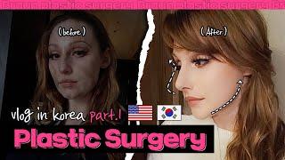 PLASTIC SURGERY IN KOREA (PART 1) I Rhinoplasty, facial contour, facelift