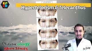 Hypertelorism and Telecanthus Plasticology Shots