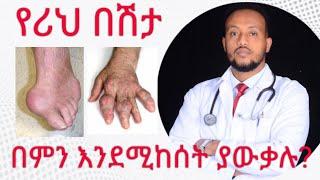 የሪህ በሽታ መንስኤና መፍትሄዎቹ/ Gaut arthritis causes and treatment | Dr. Yonathan | kedmia letenawo