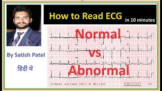 How to read an ECG, normal vs abnormal ECG @pna1 #satishpatel