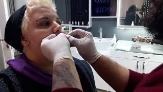 Manisa Cyber Bites Piercing (Pung Girl Get The New Piercing)