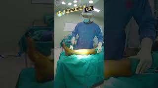 LIVE Operation Theatre Prep | Tibia Nail Fixation #shorts #doctor #neet2023 #viral