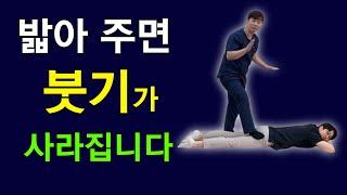 하체 부종 없애주는 최고의 방법!!문쌤재활, 문교훈 선생님과