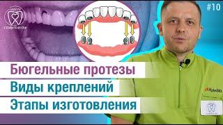 Виды бюгельных протезов: на крючках, на замках. Плюсы и минусы.  Сроки изготовления. Уход.