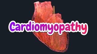 Cardiomyopathy (updated 2023) - CRASH! Medical Review Series