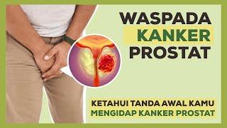 Waspada Kanker Prostat! Tanda-Tanda Ini Bisa Jadi Tidak Kamu Sadari!