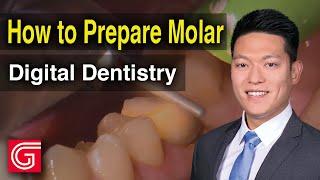 How to Prepare Molar for Digital Dentistry