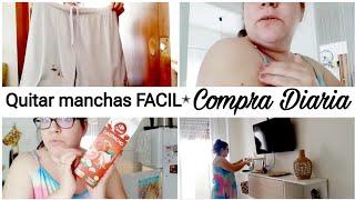 Así va mi brazo//Como quitar las manchas FACIL/Compra Diaria //Rutina diaria de AMA de CASA vlog