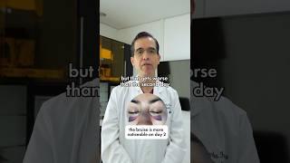 Dr.Fuentes shares insight on what to expect after a rhinoplasty 