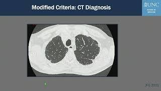 Diagnosis of UIP/IPF on CT: ATS and Fleischner Modifications Criteria (and Considerations)