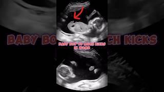 Baby boy ultrasound | Too much kicks #pregnancy #baby #babyboy #weekspregnant