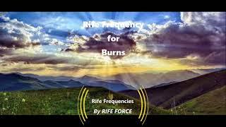 Burns - Rife Frequency