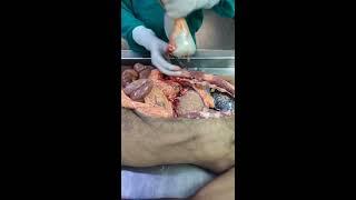 Вскрытие трупа человека +18 (autopsia)