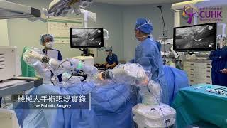 [中大醫院以微創手術機械人進行手術] CUHK Medical Centre uses minimally invasive surgical robots for surgery