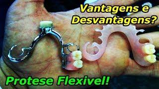 Prótese Removível Flexível - Vantagens e Desvantagens.