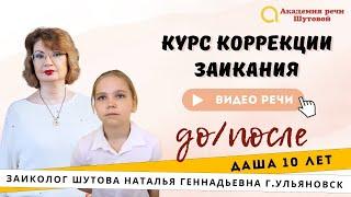 Заикание у детей - базовый  видеокурс. Заикание:Лечение заикания.