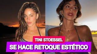 Tini Stoessel Se Hace Un Retoque Estético y Es Viral En Las Redes | VÍDEO