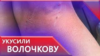 Волочкова рассказала, как ее укусила «огромная бешеная черепаха»
