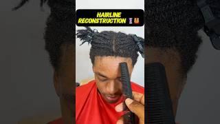 Hairline Fix Transformation‼️  #deesaucethebarber