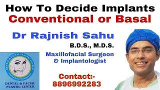 Basal Implant Procedure | Basal Implants vs conventional implants| Basal Implant| @rajnishsahu82