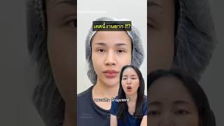 #หมอหลิน #จักษุแพทย์ #หมอตา #ศัลยกรรมตา #สารพัดเรื่องตา #ทำตาสองชั้น #กล้ามเนื้อตาอ่อนแรง