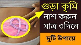 গুড়া কৃমি দূর করার উপায় কি?সুতাকৃমির লক্ষণ ও চিকিৎসা।