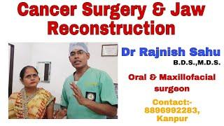 4 Years After Cancer Surgery || Jaw Cancer || Reconstruction