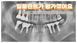 [대전치과, 대전 임플란트] 임플란트가 망가졌어요-그 증상들 그리고 그 대책들&박치과의 장점