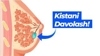 Ko'krak Kistasini qanday Yo'qotish: Haqiqat yoki Mif?