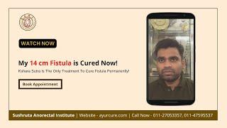 Dr. S.K. Singh Cured my 14cm Fistula | Best Fistula Clinic in Delhi, Rohini