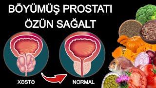 PROSTATIN EVDƏ TƏBİİ MÜALİCƏSİ - Kişilərin 90%-i Bunu Bilmir