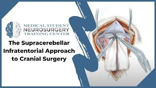 The Supracerebellar Infratentorial Approach to Cranial Surgery