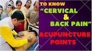 TO KNOW "CERVICAL & BACK PAIN" ACUPUNCTURE POINT'S