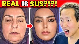 Plastic Surgeon Reacts to INSANE Turkish REAL or SUS Cosmetic Surgery Results!