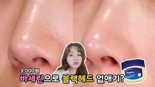 SUB) 천원 바세린으로 블랙헤드 없애기?! + 블랙헤드 클렌징오일 (피부좋아지는법) black head remover Vaseline ⎮ 미소정 MisoJeong