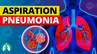 Aspiration Pneumonia (Medical Definition) | Quick Explainer Video