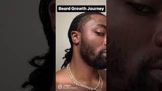 BEARD GROWTH 6 MONTH TRANSFORMSTION