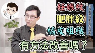 【身體雕塑】肥胖紋、妊娠紋、橘皮組織能改善嗎？形成的原因是什麼呢？【邱正宏談醫美】