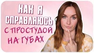 Как вылечить простуду на губах. 100% рабочие лайфхаки | Дарья Дзюба