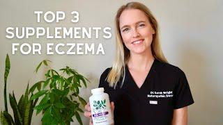 3 Best Supplements for Eczema | What I Used to Heal my Eczema Naturally