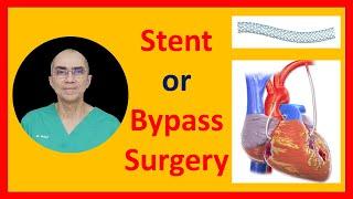 Stent or Bypass Surgery