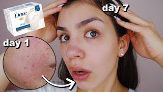 I Used Dove Soap On My Skin Everyday For One Week