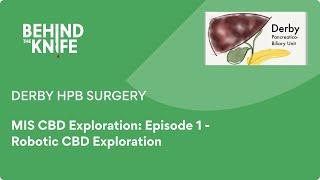 Derby HPB Surgery - MIS CBD Exploration: Episode 1 - Robotic CBD Exploration