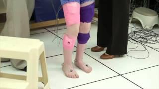 Shriners Hospitals Motion Analysis