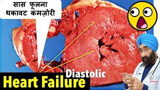 क्या होता है HFpEF : Diastolic Heart Failure with Preserved Ejection Fraction | Dr.Education