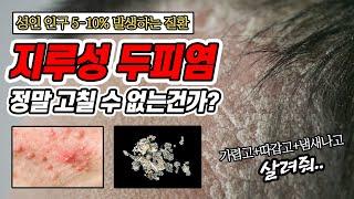 지루성 두피염 진행단계와 해결책