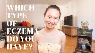 HOW to STOP ECZEMA ITCHING NATURALLY